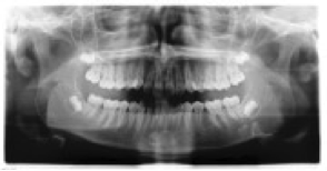 Une image contenant film radiographique, Imagerie médicale, radiologie, radiographieDescription générée automatiquement