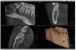 Une image contenant film radiographique, texte, Imagerie médicale, radiologieDescription générée automatiquement